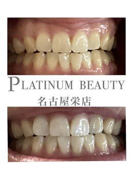 プラチナムビューティー 名古屋栄本店(PLATINUM BEAUTY)/お客様Before After