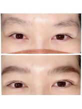 デュレ(durer.)/2）ハリウッドブロウリフト