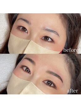 ダリ(Dali)/ハリウッドブロウリフト