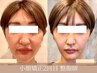 【KADOMORI式◆小顔矯正】整顔師施術/2回目以降の方★リピートでお得¥27500→