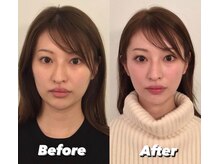 コルミチョン サロン(骨美整 salon)/Before・After