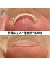 【巻き爪改善×痛み軽減】最新巻き爪ケア＋極上フットネイルケア＋ワンカラー