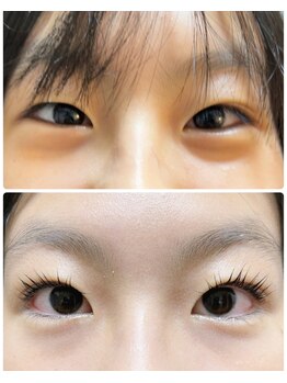 チアアップ 練馬(Cheer up)/アイリッドアップパーマ/2度がけ