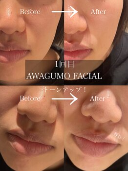 サロン エフ(salon f)/【泡雲フェイシャル】