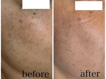 メルポール(Merport)