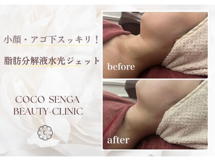 ココセンガビューティークリニック 恵比寿(COCO SENGA Beauty-Clinic)の写真