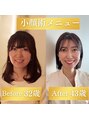 パルフェット(parfaite) 自分自身にも次世代小顔マシン&インディバを施術しています