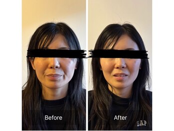 リアルボイス(REAL VOICE)/顎関節調整で小顔効果も！