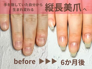 ナチュリア(Natulea)