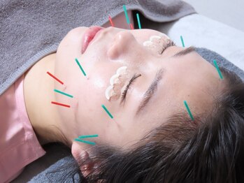 鍼灸院アム(Amu)の写真/【美容鍼×ヘッドスパの相乗効果】 顔だけでなく頭皮から引き上げるリフトアップ効果で印象も変わる◎