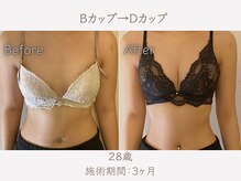 ハリスタ 三宮院(HARISTA)/3ヶ月間でBカップ→Dカップ