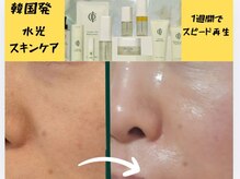 マールム(MALUM)/インセルダム