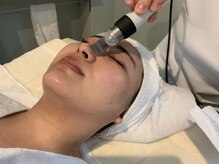 ポーラ 上野芝店(POLA)/黒ずみすっきり