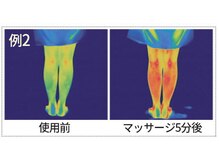 レビーリズ バイ サロンリーナ(Revie Liz)/むくみもおさらば！美脚美尻へ