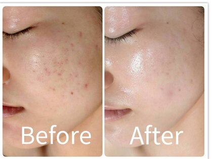 サロン ド ヒノキ(Salon de HINOKI)の写真