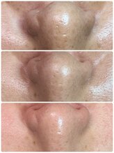 グリーン(green)/これまた全部before！！