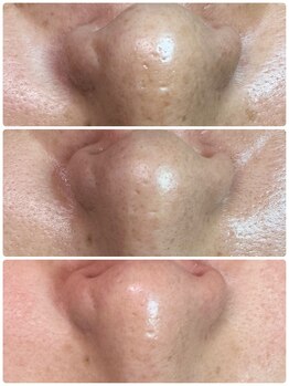 グリーン(green)/これまた全部before!!