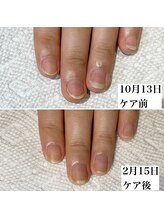 コロレ(colore)/美爪育成コース