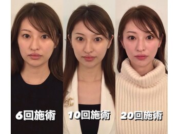 コルミチョン サロン(骨美整 salon)/Before・After