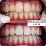 イージーホワイトニング 中野店(easy whitening)