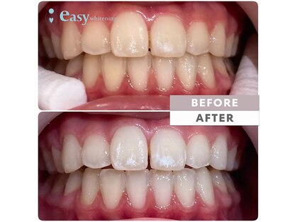 イージーホワイトニング 中野店(easy whitening)の写真