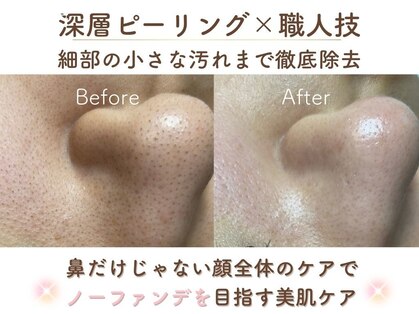 ミサズ スキンケア(misa's skin care)の写真