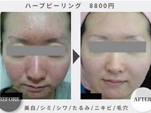 ワンバイゼロ(One by zero)