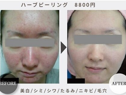 ワンバイゼロ(One by zero)の写真