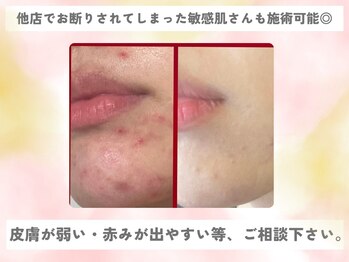 デュクレ(Beauty Clinic Ducle)