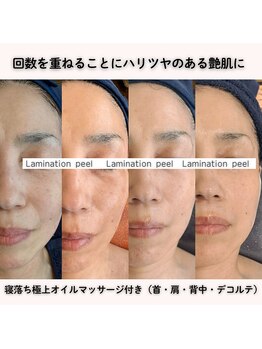 ココロ(COCORO)/人気No.1 ラミネーションピール