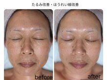 グロウ バイ フェイシャルデザイン アンド アイ(GROW)/フェイスライン