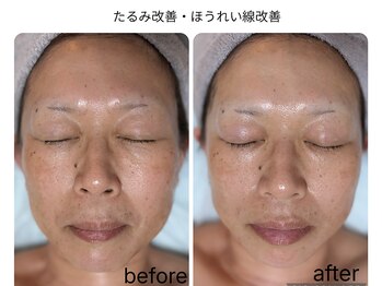 グロウ バイ フェイシャルデザイン アンド アイ(GROW)/フェイスライン