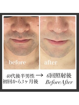 エリクサー 加須店(Elixir)/6回で伸びるスピード遅くなる!?
