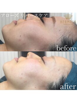 トータルエステティック ビューティスト 足利店(Total Easthetic Beautist)/アローズリバースケア