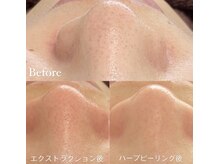 エマ(emma)/同時施術できるのはここだけ！