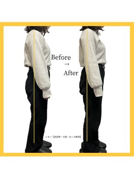 美容整体 レモン/ひざ裏伸びて美脚に☆