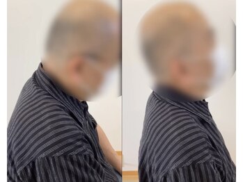 ランドル(rendre)/70代男性　姿勢改善