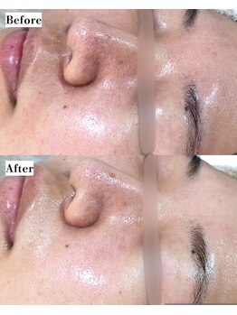 ソワナ(soina)/【神楽坂駅/フェイシャル/毛穴】