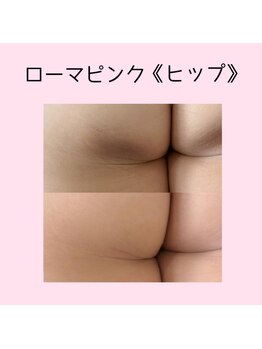 ファースト(1st)/