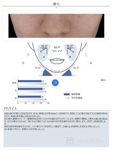 ヴィオラ 松戸店(Viola)/最新AI肌診断機導入