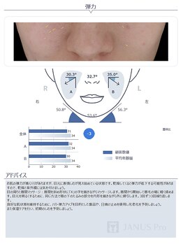 ヴィオラ 松戸店(Viola)/最新AI肌診断機導入