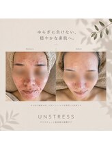 オウトウキョウ 広尾(AWEtokyo)/クリスティーナ　アンストレス