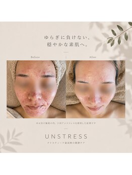 オウトウキョウ 広尾(AWEtokyo)/クリスティーナ　アンストレス