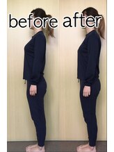 名駅整体院/そり腰（施術前・施術後）