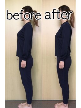 名駅整体院/そり腰(施術前・施術後)