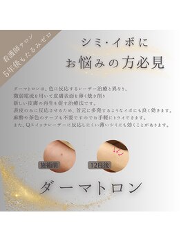 クリニカルボーテ 心斎橋院(CLINICAL BEAUTE)/シミにお悩みの方へ◎