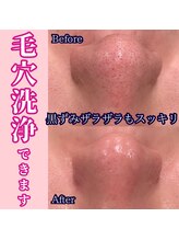 シオン 高崎(S'ion)/【毛穴洗浄フェイシャル】