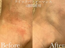 シェリーミル(Cherie Miru)/クリスティーナホームケア使用