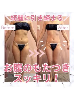 ビューティエン(beauty EN)/痩身ダイエットマッサージエステ