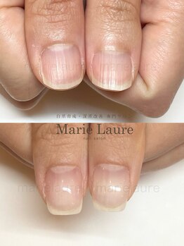 マリーロール 淀屋橋本店(Marie Laure)/自爪育成/深爪矯正/ネイルケア
